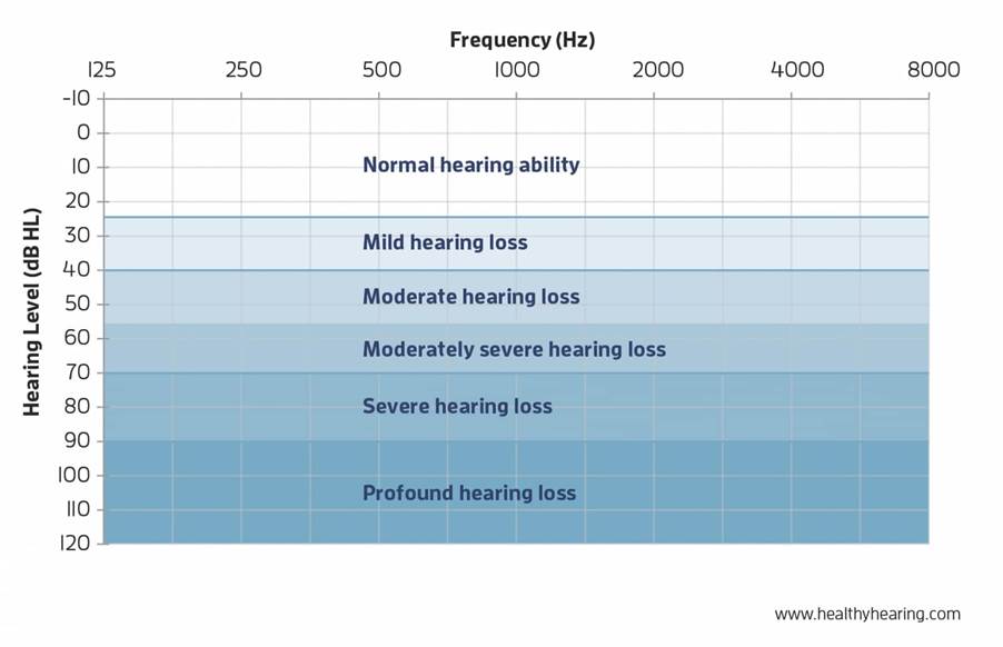 audiogram showing degrees of hearing loss