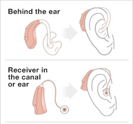 Styles of Hearing Aids: Behind the ear, Receiver in the canal or ear, In the ear, In the canal, and Completely in the canal